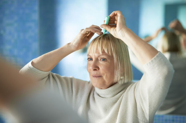 Kobieta stosuje preparat na łysienie androgenowe 