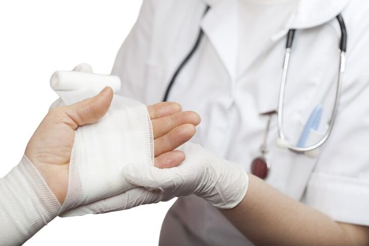 Opatrywanie ręki po oparzeniu skóry