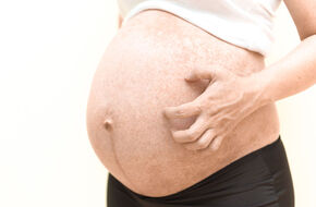 Kobieta w ciąży drapie się po brzuchu