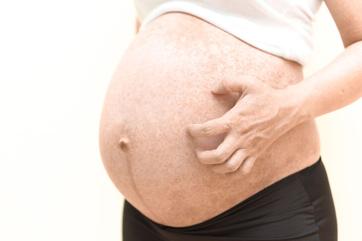 Kobieta w ciąży drapie się po brzuchu
