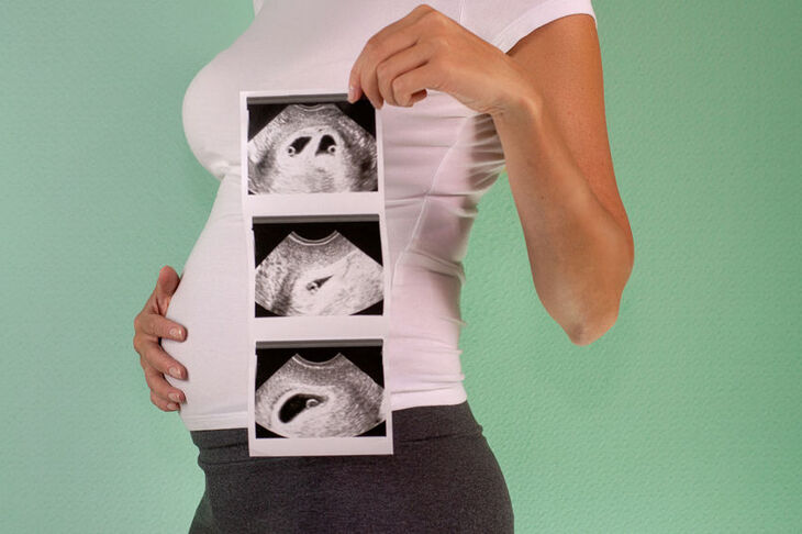 Kobieta w ciąży bliźniaczej pokazuje zdjęcie USG