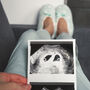 Kobieta trzyma w dłoni zdjęcie z badania USG w ciąży