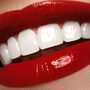 Piękne białe zęby 