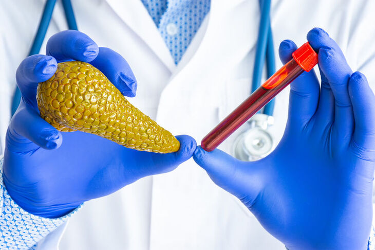 Lekarz trzyma w dłoni próbkę do badania amylazy w surowicy krwi