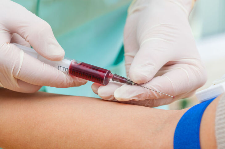 Pielęgniarka pobiera krew do badania 17-OH-progesteronu