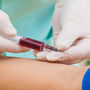 Pielęgniarka pobiera krew do badania 17-OH-progesteronu