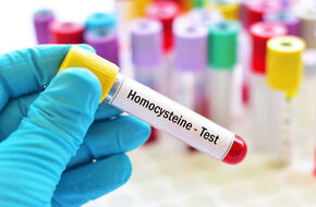 Naukowiec wykonuje test na stężenie homocysteiny