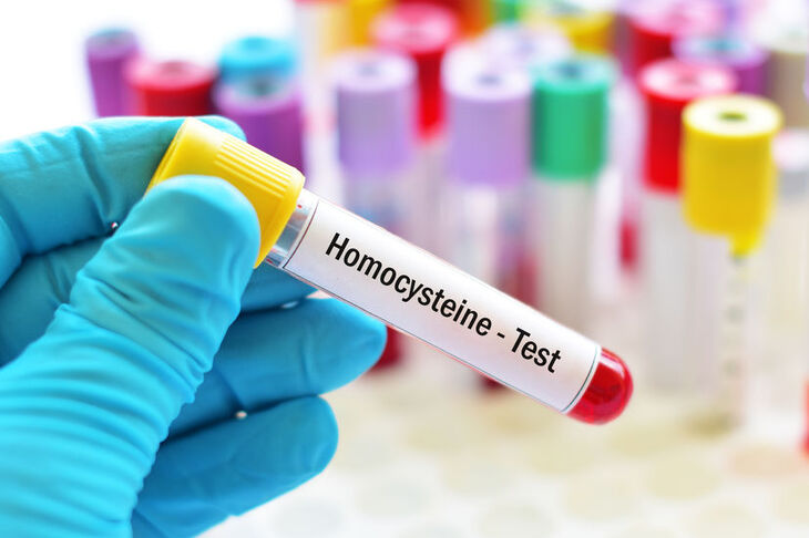 Naukowiec wykonuje test na stężenie homocysteiny