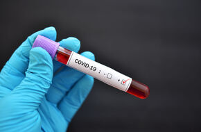 Próbka do badań na koronawirusa