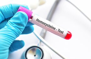 Badanie homocysteiny