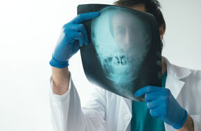 Lekarz diagnozuje kostniaka czaszki
