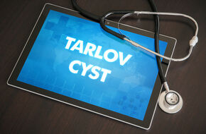Tablet wyświetlający napis torbiel Tarlova