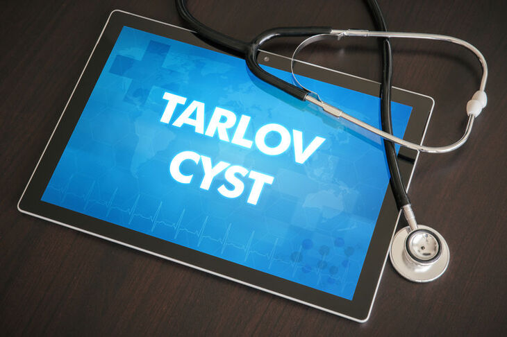 Tablet wyświetlający napis torbiel Tarlova