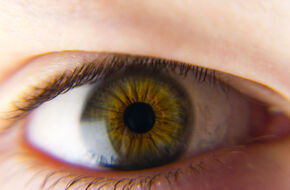 Oko z widocznymi guzkami Lischa