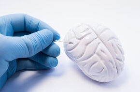 Model mózgu człowieka 