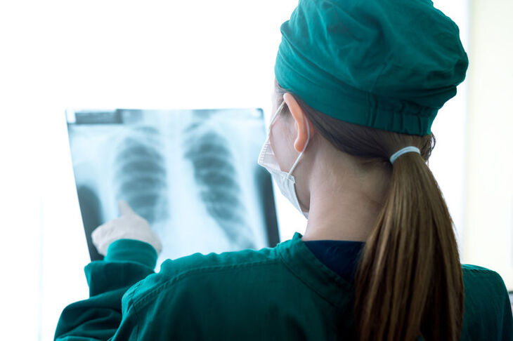 Lekarz ogląda zdjęcie RTG płuc