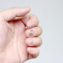 Dłoń z przebarwieniami na paznokciach