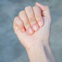Dłoń z białymi plamkami na paznokciach