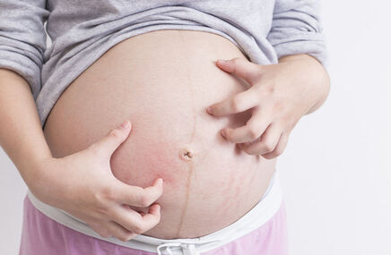 Kobieta w ciąży drapie się po brzuchu