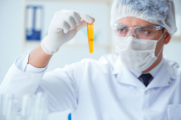 Laborant trzyma w dłoni próbkę moczu