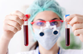 Hematolog trzyma próbki krwi