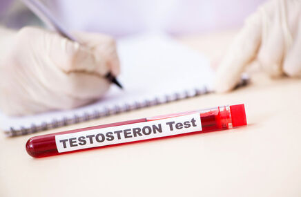 Badanie testosteronu