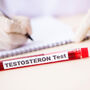 Badanie testosteronu