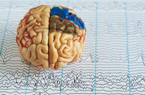Model mózgu i wynik badania EEG