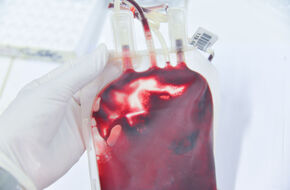 Krew z czynnikiem rh-