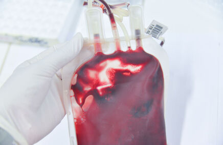 Krew z czynnikiem rh-