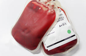 Próbka z pobraną krwią z grupy A