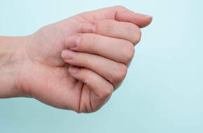 Dłoń z połamanymi paznokciami