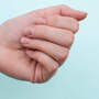 Dłoń z połamanymi paznokciami