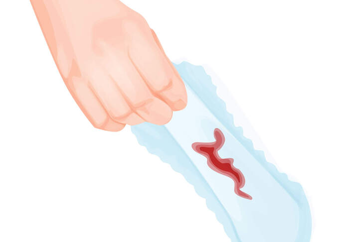 Grafika przedstawiające krwawe upławy