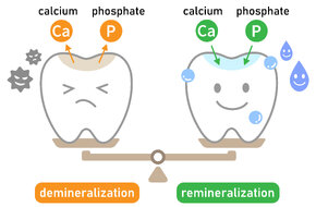 Remineralizacja szkliwa jest procesem przeciwnym do demineralizacji