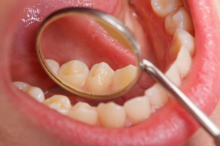 Zbliżenie na wnętrze jamy ustnej