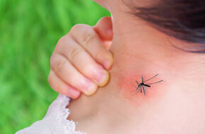 Uczulenie na komary na szyi