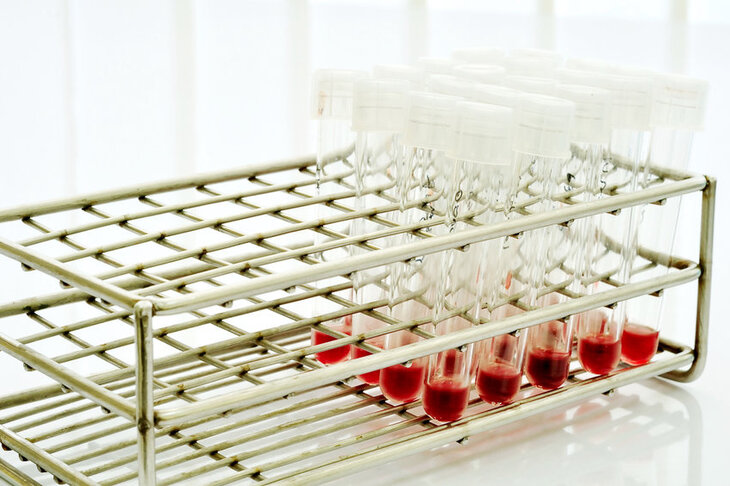 Próbki krwi do badania cystometrii przepływowej