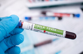 Próbka krwi z wirusem ebola