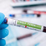 Próbka krwi z wirusem ebola