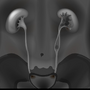 Zdjęcie rentgenowskie wykonane w urografii