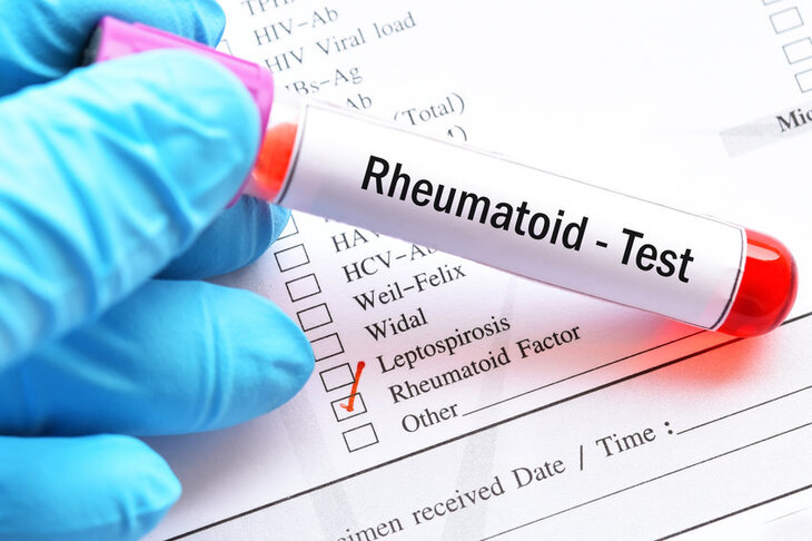 Test czynnika reumatoidalnego