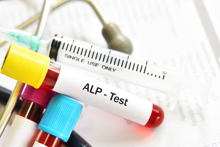 Próba z krwią do badania poziomu fosfatazy alkalicznej