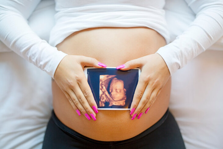 Kobieta w ciąży trzyma zdjęcie z USG 3D