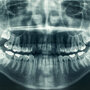 Zdjęcie pantomograficzne zębów