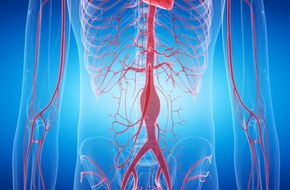 Wizualizacja tętniaka aorty