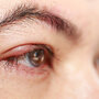 Ludzkie oko z objawem zapalenie nerwu wzrokowego