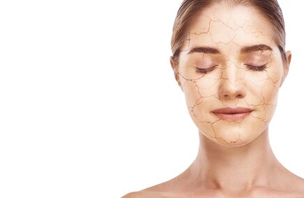 Kobieta z problemem suchej skóry na twarzy