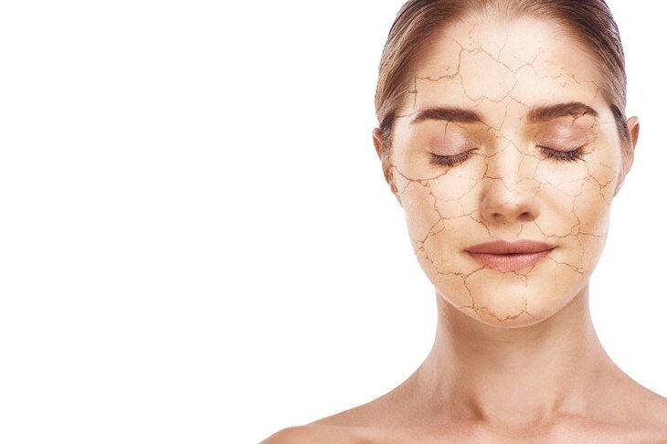 Kobieta z problemem suchej skóry na twarzy