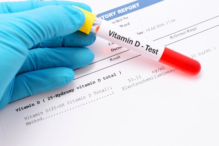 Próbka krwi do badania poziomu witaminy D